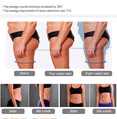 EMSzero Body Sculpting Machine – 15 Tesla RF Muscle Stimulator, 6500W Power