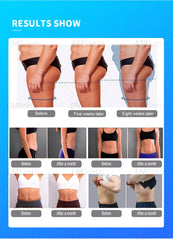 EMSzero Inner Ball Roller Machine – RF Cellulite Massage & Skin Tightening Device